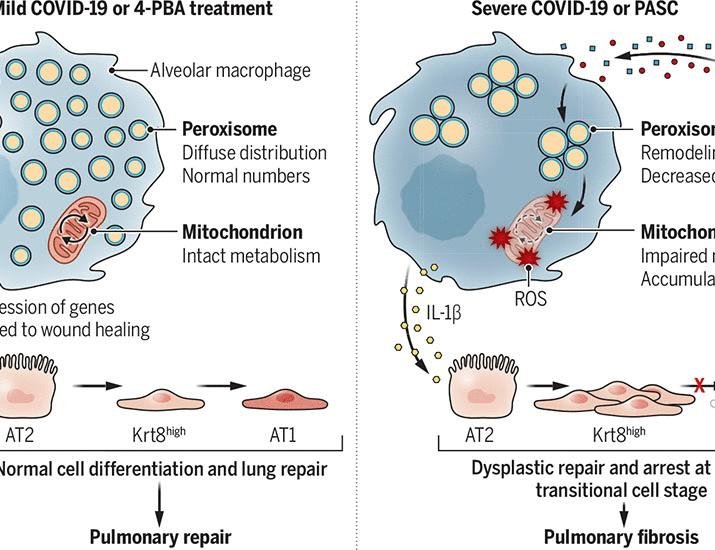 Lung inflammation drives Long Covid | Science