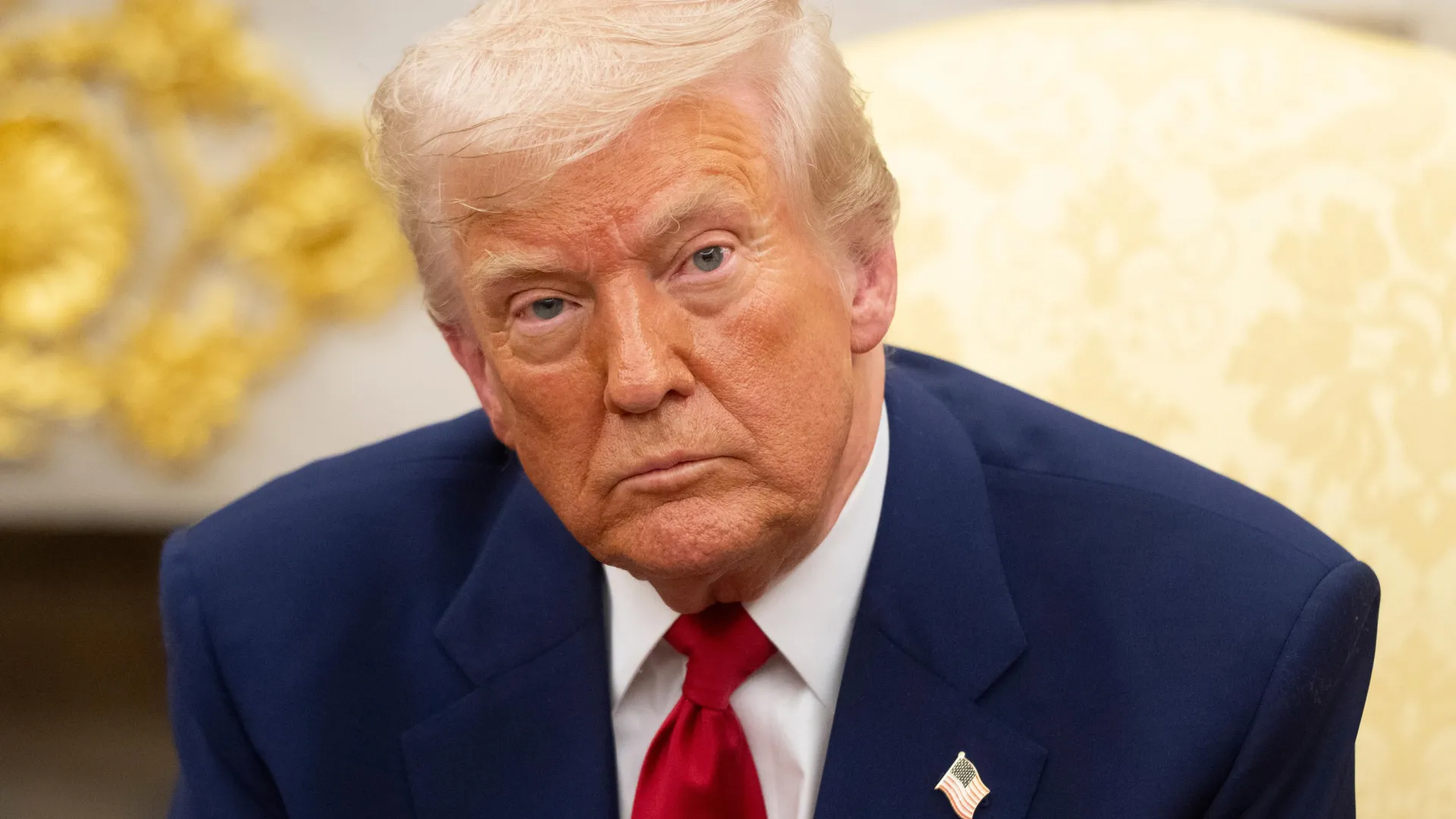 Why Trump’s leg swelling could be a warning sign for millions