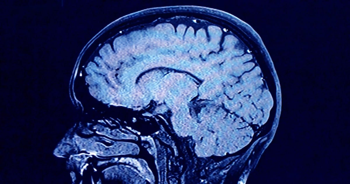 Human brains have 5 distinct ‘epochs’ in a lifetime, study finds