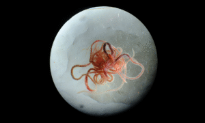 The Broom-Like Quality of Worms