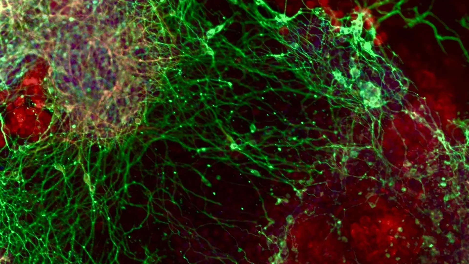 A massive gene hunt reveals how brain cells are made