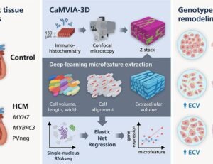 Deep-learning analysis of 3D microarchitectural remodeling in hypertrophic cardiomyopathy | Science