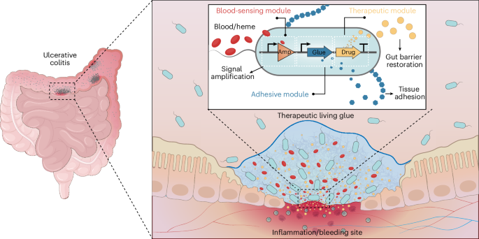 Engineered living glues secrete therapeutic proteins for treatment of inflammatory bowel disease